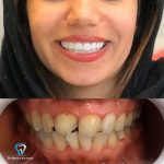 بهترین دندانپزشک زیبایی دکتر مهسا کوکبی در شیراز