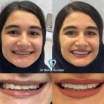 بهترین دندانپزشک زیبایی دکتر مهسا کوکبی در شیراز