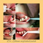 بهترین دندانپزشک مجتهد زاده در پردیس