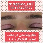 دکتر مشهود تقی لو در زنجان