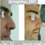 دکتر مشهود تقی لو در زنجان