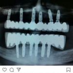 دکتر ابوالفضل صفیری دندانپزشک در تهران