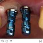 دکتر ابوالفضل صفیری دندانپزشک در تهران