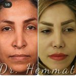 دکتر سیف اله همت در تهران