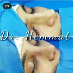 دکتر سیف اله همت در تهران