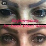 دکتر سعید عباسی معین در بندر انزلی