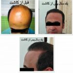 دکتر سعید عباسی معین در بندر انزلی