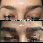 دکتر سعید عباسی معین در بندر انزلی