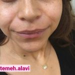 دکتر سیده فاطمه علوی لنگرودی در تهران