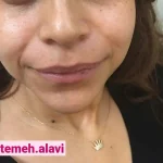 دکتر سیده فاطمه علوی لنگرودی در تهران