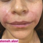 دکتر سیده فاطمه علوی لنگرودی در تهران