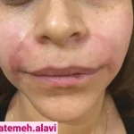 دکتر سیده فاطمه علوی لنگرودی در تهران