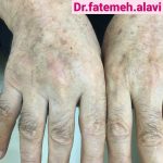 دکتر سیده فاطمه علوی لنگرودی در تهران