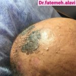 دکتر سیده فاطمه علوی لنگرودی در تهران