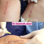 دکتر سیده فاطمه علوی لنگرودی در تهران