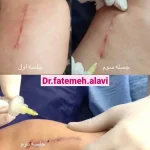 دکتر سیده فاطمه علوی لنگرودی در تهران