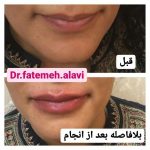 دکتر سیده فاطمه علوی لنگرودی در تهران