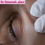 دکتر سیده فاطمه علوی لنگرودی در تهران