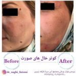 دکتر ساقی فاطمی طبائی در اصفهان و بروجن