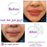 دکتر ساقی فاطمی طبائی در اصفهان و بروجن