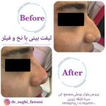 دکتر ساقی فاطمی طبائی در اصفهان و بروجن