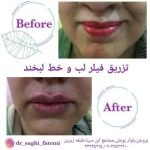 دکتر ساقی فاطمی طبائی در اصفهان و بروجن