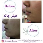 دکتر ساقی فاطمی طبائی در اصفهان و بروجن