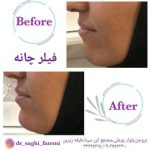 دکتر ساقی فاطمی طبائی در اصفهان و بروجن