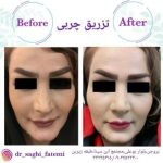 دکتر ساقی فاطمی طبائی در اصفهان و بروجن