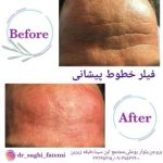 دکتر ساقی فاطمی طبائی در اصفهان و بروجن