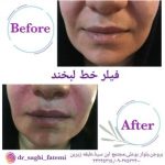 دکتر ساقی فاطمی طبائی در اصفهان و بروجن