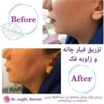 دکتر ساقی فاطمی طبائی در اصفهان و بروجن