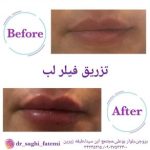 دکتر ساقی فاطمی طبائی در اصفهان و بروجن