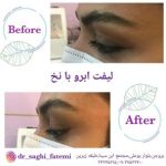 دکتر ساقی فاطمی طبائی در اصفهان و بروجن