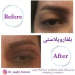 دکتر ساقی فاطمی طبائی در اصفهان و بروجن