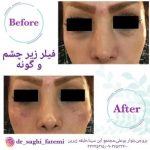 دکتر ساقی فاطمی طبائی در اصفهان و بروجن