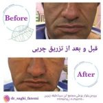 دکتر ساقی فاطمی طبائی در اصفهان و بروجن