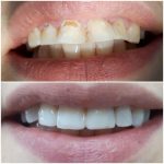 دکتر رضا قلی پور راد در بابل