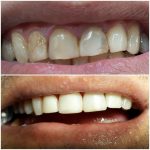 دکتر رضا قلی پور راد در بابل