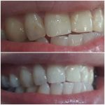 دکتر رضا قلی پور راد در بابل