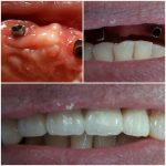 دکتر رضا قلی پور راد در بابل