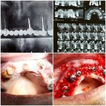 دکتر رضا قلی پور راد در بابل