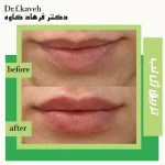 دکتر فرهاد کاوه در کرج