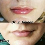 دکتر زهرا جاودان در اصفهان