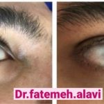 دکتر سیده فاطمه علوی لنگرودی در تهران