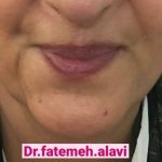 دکتر سیده فاطمه علوی لنگرودی در تهران