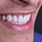 دکتر الهام قناطیر در اهواز