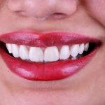 دکتر الهام قناطیر در اهواز