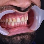 دکتر الهام قناطیر در اهواز