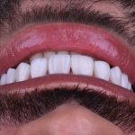 دکتر الهام قناطیر در اهواز